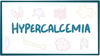 Hypercalcemia  causes symptoms diagnosis treatment pathology [upl. by Yrolam]