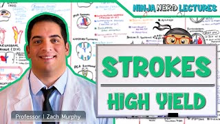 Ischemic and Hemorrhagic Strokes  High Yield [upl. by Oby]