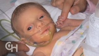 Why Some Babies Are Born With Organs On The Outside [upl. by Dean]