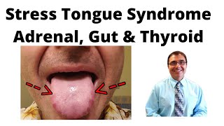 TongueTie vs Tongue Thrust  Whats The Difference [upl. by Emina]