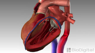 3D Medical Animation  Congestive Heart Failure [upl. by Sammons328]