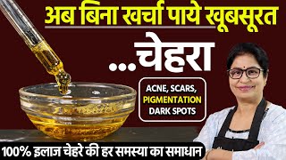 कितने भी पुराने ACNE SCARS PIGMENTATION DARK CIRCLE होंगे जड़ से खत्म  100 ग्लो आयेगा Skin Care [upl. by Ybba]