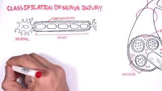 Neurology  Nerve Damage and Regeneration [upl. by Onfre856]