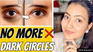 Remove DARK CIRCLES Permanently In 7 Days  100 Results [upl. by Brottman]