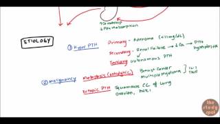 Hypercalcemia for USMLE Step 1 and USMLE Step 2 [upl. by Novikoff]