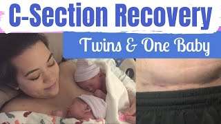 CSECTION RECOVERY TWINS amp BABY  CSection Recovery Tips  Postpartum Care  Mai Zimmy [upl. by Jansen]