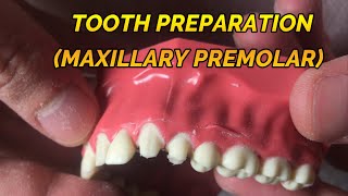 CROWN PREPARATION TUTORIAL MAXILLARY PREMOLAR [upl. by Urissa]