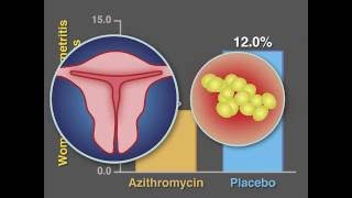 PostCesarean Infection and Antibiotic Prophylaxis  NEJM [upl. by Giff8]